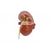 model chorej nerki - 1019550 3b scientific modele anatomiczne 4